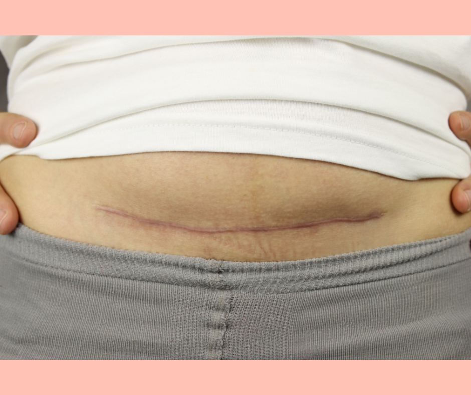 Vero allaite conseillère en allaitement blog