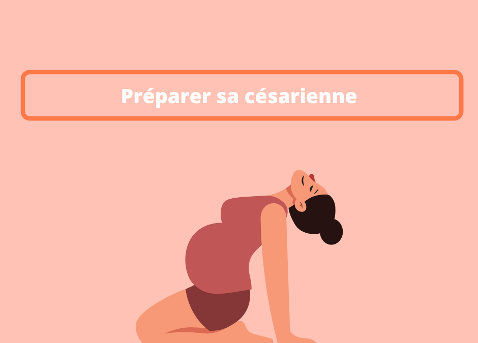 Préparer sa césarienne